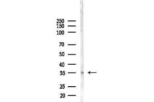 anti-Visual System Homeobox 1 (VSX1) (C-Term) antibody