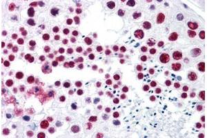 Human Testis: Formalin-Fixed, Paraffin-Embedded (FFPE)