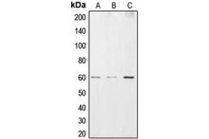 Western blot analysis of CSRNP2 expression in HEK293T (A), HepG2 (B), HuvEC (C) whole cell lysates.
