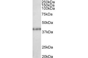 ABIN184882 (1µg/ml) staining of Rat Kidney lysate (35µg protein in RIPA buffer).