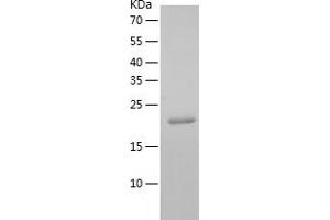 Western Blotting (WB) image for RAP1B, Member of RAS Oncogene Family (RAP1B) (AA 1-181) protein (His tag) (ABIN7124777)