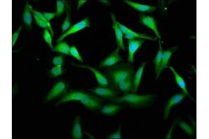 Immunofluorescence staining of Hela cells with ABIN7166908 at 1:175, counter-stained with DAPI. (PKM anticorps  (AA 185-461))