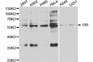 Western blot analysis of extracts of various cell lines, using VIM antibody. (Vimentin anticorps  (AA 1-200))
