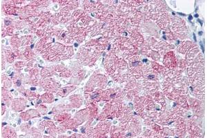 Human Heart, Cardiac Myocytes (formalin-fixed, paraffin-embedded) stained with SLC2A4 antibody ABIN218433 at 10-20 ug/ml followed by biotinylated goat anti-rabbit IgG secondary antibody ABIN481713, alkaline phosphatase-streptavidin and chromogen. (GLUT4 anticorps)