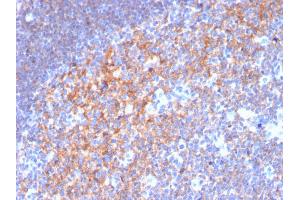 Formalin-fixed, paraffin-embedded human Tonsil stained with CD19 Monospecific Mouse Monoclonal Antibody (CD19/3116).