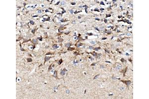 IHC analysis of CHRM1 using anti-CHRM1 antibody (ABIN7602749).