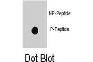 Dot blot analysis of INSR (phospho Y1185) polyclonal antibody  on nitrocellulose membrane. (Insulin Receptor anticorps  (pTyr1185))