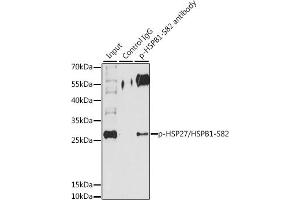 Immunoprecipitation analysis of 200 μg extracts of HeLa cells, using 3 μg Phospho-HSP27/HSPB1-S82 pAb (ABIN3023549, ABIN3023550, ABIN3023551 and ABIN6225403).