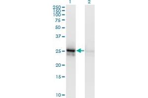Western Blot analysis of ALDOA expression in transfected 293T cell line by ALDOA monoclonal antibody (M01), clone 3D9-6F3.