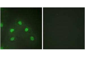 Immunofluorescence analysis of HeLa cells, using hnRNP L Antibody. (HNRNPL anticorps  (AA 61-110))
