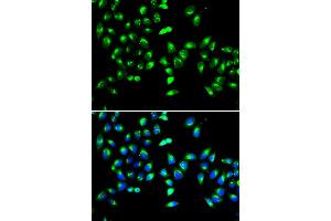 Immunofluorescence analysis of HeLa cell using GALNT2 antibody. (GALNT2 anticorps)
