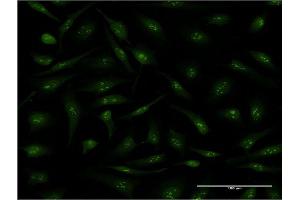 Immunofluorescence of monoclonal antibody to PPID on HeLa cell.