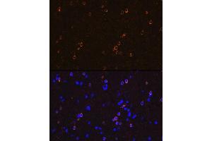 Immunofluorescence analysis of rat brain using NMD Rabbit mAb (ABIN7267417) at dilution of 1:100 (40x lens). (GRIN1/NMDAR1 anticorps)