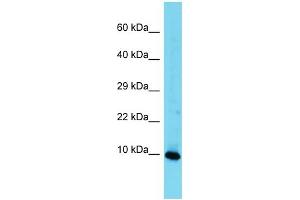 Western Blotting (WB) image for anti-High Mobility Group Nucleosomal Binding Domain 3 (HMGN3) (Middle Region) antibody (ABIN2788959) (HMGN3 anticorps  (Middle Region))