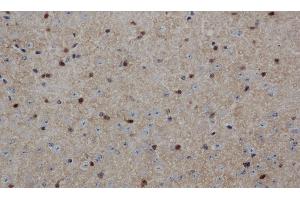 Immunohistochemistry of paraffin-embedded Mouse brain using ENO1 Polyclonal Antibody at dilution of 1:50 (ENO1 anticorps)