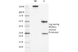SDS-PAGE Analysis Purified CD84 Mouse Monoclonal Antibody (152-1D5). (CD84 anticorps)