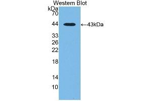 Detection of Recombinant CTBS, Human using Polyclonal Antibody to Di-N-Acetyl Chitobiase (CTBS) (CTBS anticorps  (AA 47-385))