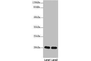 Western Blot All lanes: CABP5 antibody at 12 μg/mL Lane 1: Mouse kidney tissue Lane 2: Mouse thymus tissue Secondary Goat polyclonal to rabbit IgG at 1/10000 dilution Predicted band size: 20 kDa Observed band size: 20 kDa (CABP5 anticorps  (AA 1-173))