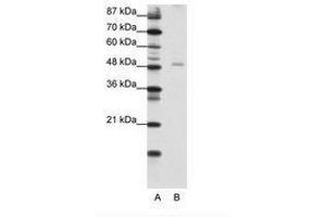 Image no. 1 for anti-Nuclear Factor I/B (NFIB) (AA 187-236) antibody (ABIN202482) (NFIB anticorps  (AA 187-236))