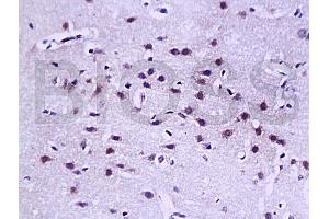 Formalin-fixed and paraffin embedded rat brain tissue labled with Anti-LAMR1(CT) Polyclonal Antibody, Unconjugated (ABIN729598) at 1:200, followed by conjugation to the secondary antibody and DAB staining (LAMR1CT (AA 201-295) anticorps)