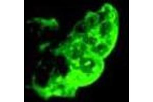 Immunofluorescence staining of methanol-fixed NTERA-2 cl. (TRA1-81 anticorps)
