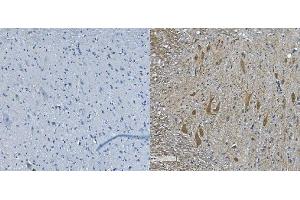 IHC analysis of NEFL/NF-L using anti-NEFL/NF-L antibody (ABIN7601626).