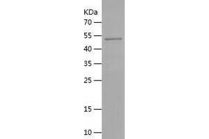 Western Blotting (WB) image for Pre-B-Cell Leukemia Homeobox Protein 2 (PBX2) (AA 1-256) protein (His-IF2DI Tag) (ABIN7124545)
