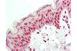 anti-E74-Like Factor 2 (Ets Domain Transcription Factor) (ELF2) (AA 103-152) antibody