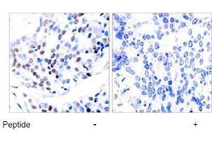 Image no. 1 for anti-Jun Proto-Oncogene (JUN) (Thr239) antibody (ABIN197134) (C-JUN anticorps  (Thr239))