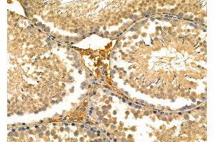 ABIN6263750 and ABIN6277026 at 1/100 staining Rat testis tissue by IHC-P.