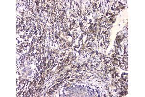 IHC analysis of HECTD3 using anti-HECTD3 antibody (ABIN6719595).