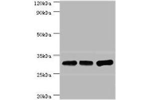 Western blot All lanes: HNRNPA0 antibody at 12 μg/mL Lane 1: Mouse brain tissue Lane 2: Hela whole cell lysate Lane 3: Jurkat whole cell lysate Secondary Goat polyclonal to rabbit IgG at 1/10000 dilution Predicted band size: 31 kDa Observed band size: 31 kDa (HNRNPA (AA 1-180) anticorps)