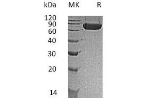 Western Blotting (WB) image for Kin of IRRE Like 1 (NEPH1) protein (His tag) (ABIN7320809)