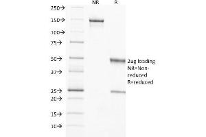 SDS-PAGE Analysis Purified TIMP2 Mouse Monoclonal Antibody (3A4).