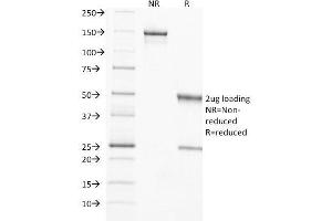 SDS-PAGE Analysis Purified TIMP2 Mouse Monoclonal Antibody (3A4). (TIMP2 anticorps  (N-Term))