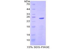 SDS-PAGE analysis of Mouse Sprouty Homolog 2 Protein.