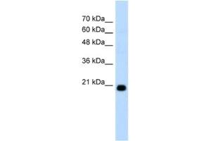 Western Blotting (WB) image for anti-F-Box Protein 25 (FBXO25) antibody (ABIN2462666)