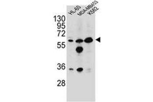 western blot analysis of Glycine amidinotransferase antibody (N-term) in HL-60,MDA-MB453,K562 cell line lysates (35ug/lane). (GATM anticorps  (N-Term))
