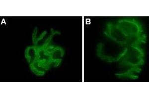 α-Bungarotoxin-ATTO Fluor-488 in whole mount staining of mouse Gastrocnemius muscle. (alpha-Bungarotoxin protein (Atto 488))