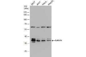 WB Image Laforin antibody detects Laforin protein by western blot analysis.