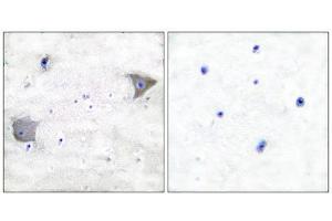 Immunohistochemistry (IHC) image for anti-Platelet Derived Growth Factor Receptor alpha (PDGFRA) (C-Term) antibody (ABIN1848739) (PDGFRA anticorps  (C-Term))