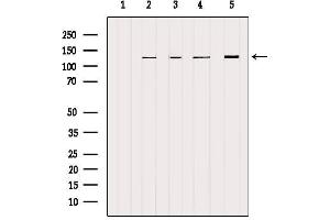 Western blot analysis of extracts from various samples, using NCKAP1 Antibody. (NCKAP1 anticorps  (Internal Region))
