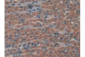 anti-Gremlin 1 (GREM1) (AA 26-184) antibody