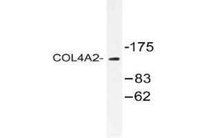 Western blot (WB) analysis of COL4A2 antibody in extracts from Jurkat cells. (COL4a2 anticorps  (Chain alpha 2))