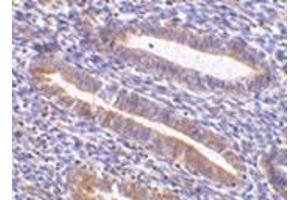 Immunohistochemistry of TIM-1 in human uterus tissue with this product at 10 μg/ml.