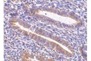 Immunohistochemistry of TIM-1 in human uterus tissue with this product at 10 μg/ml. (HAVCR1 anticorps  (N-Term))