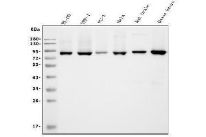 Western blot analysis of APPL/APPL1 using anti-APPL/APPL1 antibody (ABIN7602659).