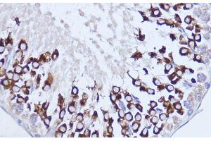 Immunohistochemistry of paraffin-embedded Rat testis using Polyclonal AntibodyPC1 Polyclonal Antibody at dilution of 1:100 (40x lens). (PC1 anticorps)