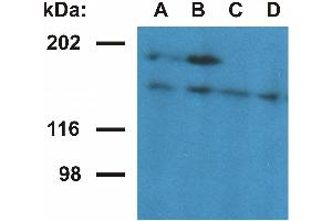 Western blotting analysis of ubinuclein in nuclear fraction of HeLa cells. (Ubinuclein 1 anticorps  (AA 1-190))