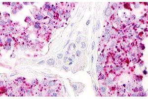 Image no. 1 for anti-Lysophosphatidic Acid Receptor 5 (LPAR5) (Cytoplasmic Domain) antibody (ABIN1049018)